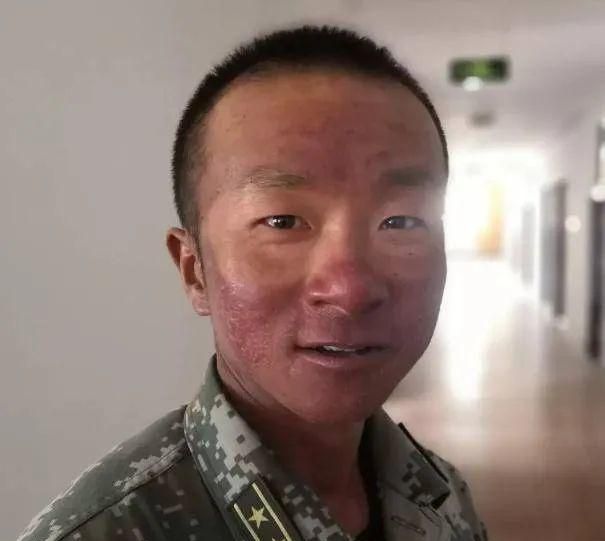 参加阅兵的战士脸上留下V字晒痕参加阅兵的战士脸上留下的V字晒痕，荣耀与坚韧的象征
